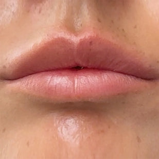 Apply to Your Lips